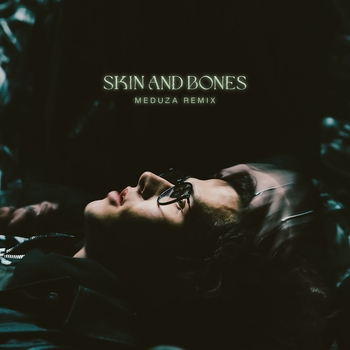 Skin and Bones